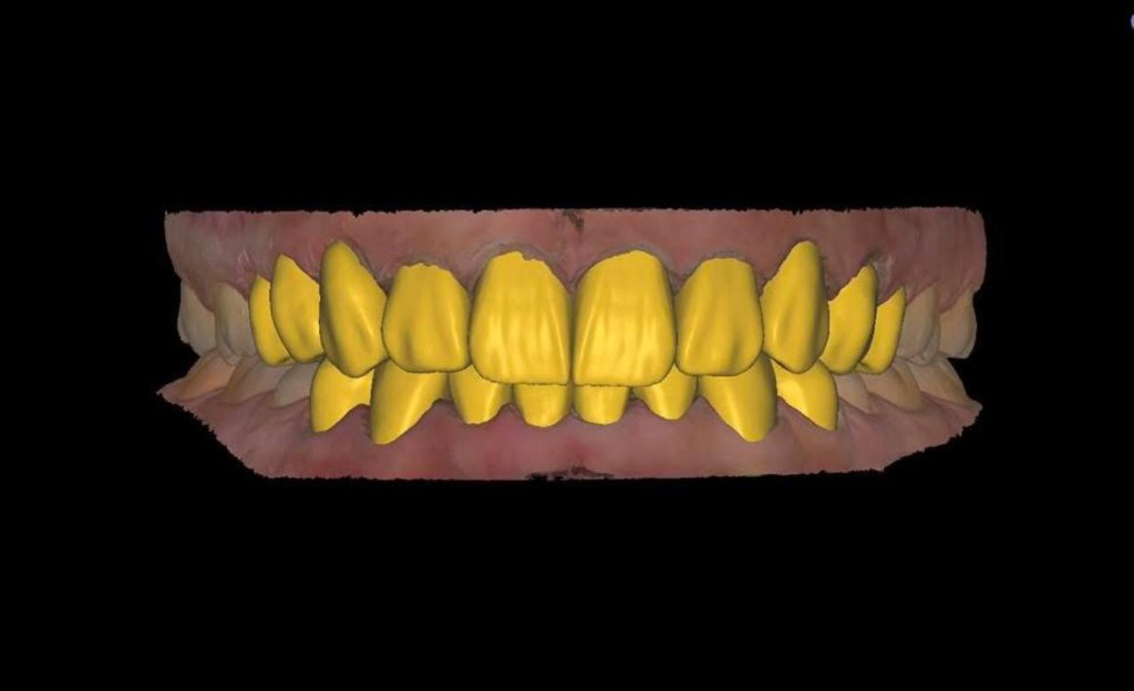 CAD case